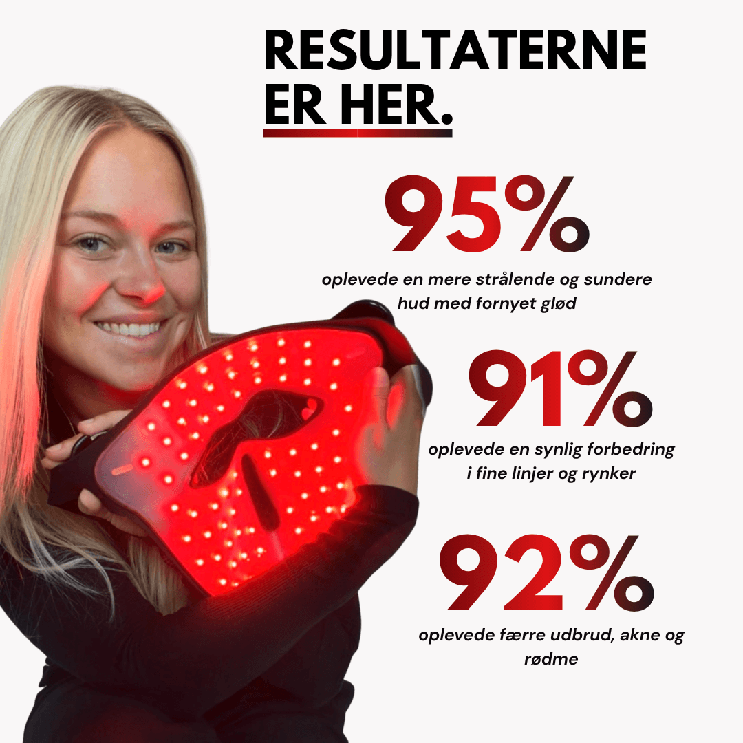 Mozion Red Light Glow Mask